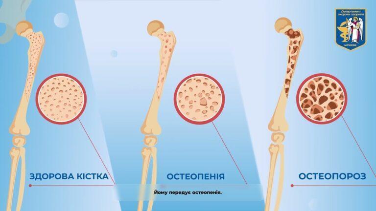 Інформаційно-просвітницькі відеоролики програми “Громадське здоров’я”